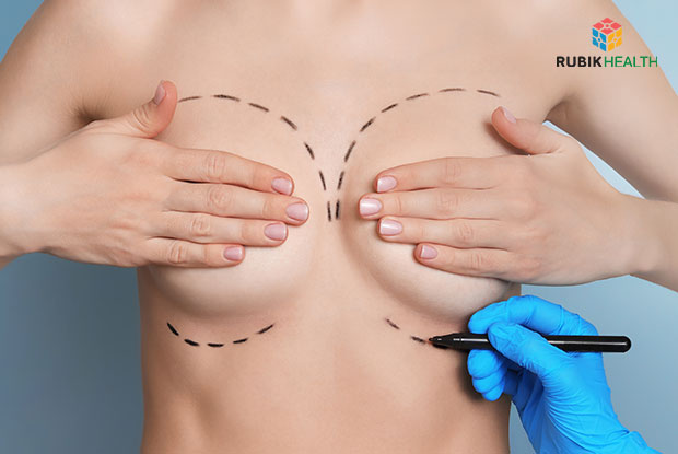 Breast Augmentation with round implants (Mentor Silicone) - More then 400 ml.