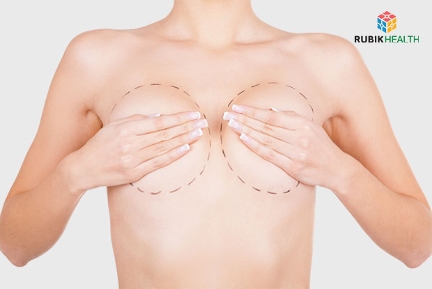 Breast Augmentation with teardrop implants (Mentore Silicone) - More then 400 ml.