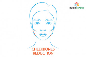 Cheek Bone Reduction (Zygomatic)