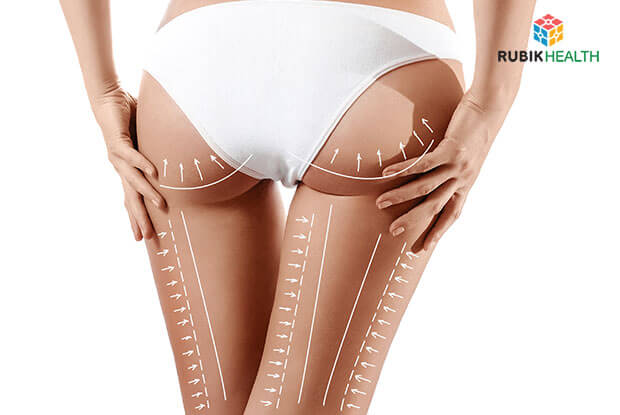 威塑吸脂术- 大腿套餐（前侧、后侧、内侧及外侧）【泰爱医疗：泰国健康 
