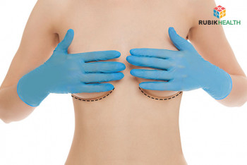 Breast Augmentation - Silicone Cohesive Gel Implants (Round)