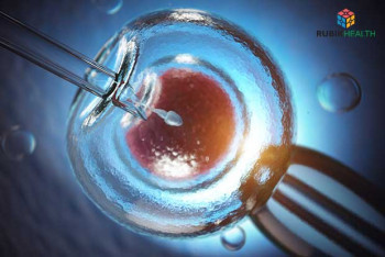 IVF + ICSI Package - Over 40 Years