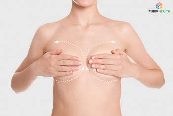 Breast Augmentation - Anatomical Shape Implants (Tear Drop)