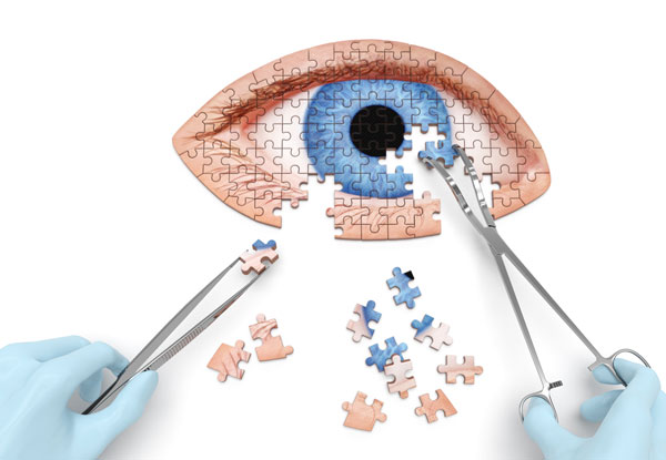 Be careful! The side effect that may occur after eyelid surgery