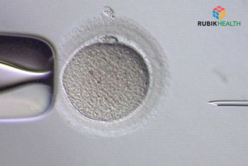 IVF Package with PGD24