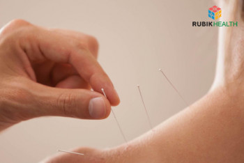 Acupuncture for Office Syndrome