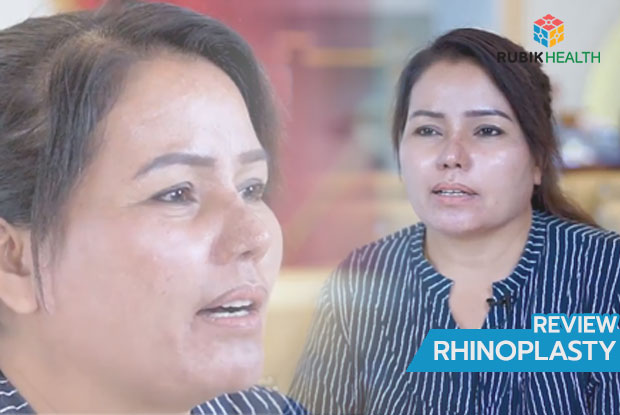 Revision rhinoplasty