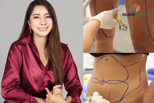 Two-kids mother being MC and model having body liposuction